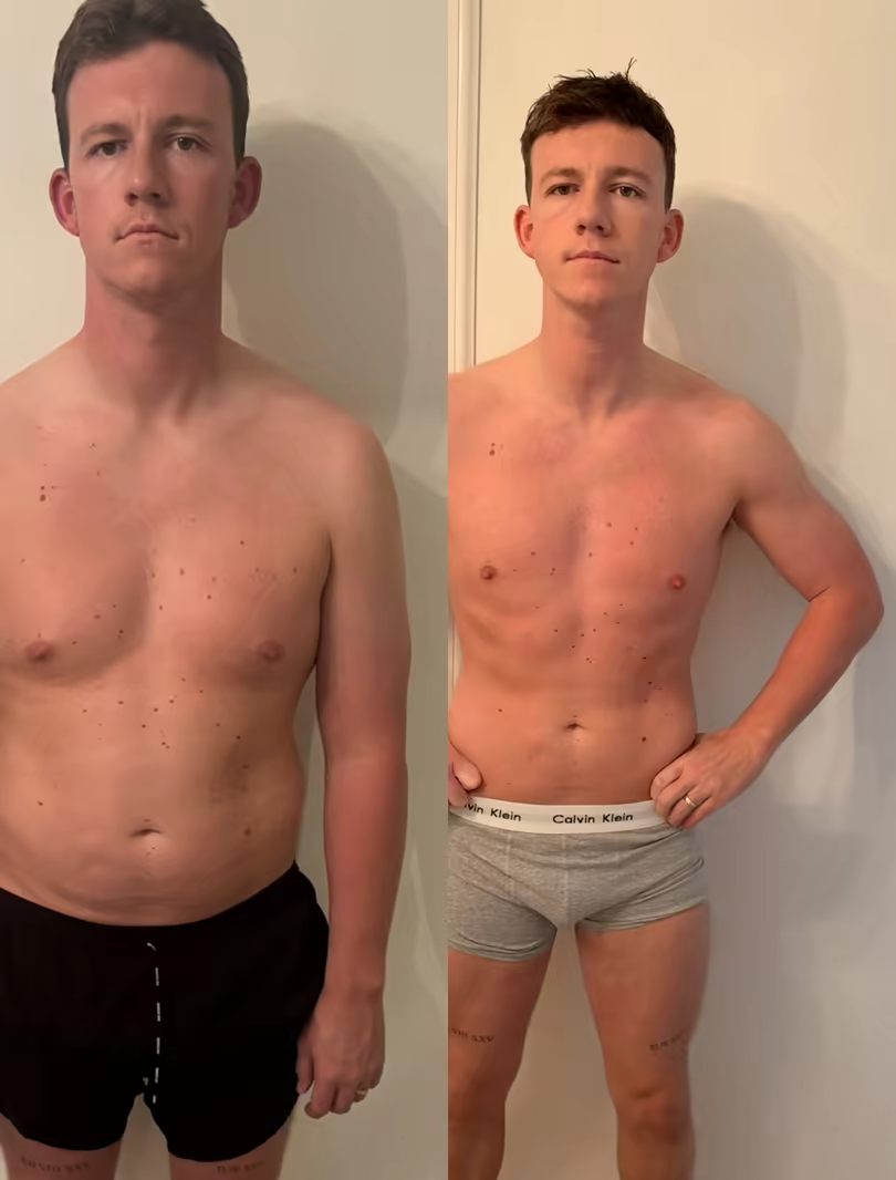 Danny — before and after