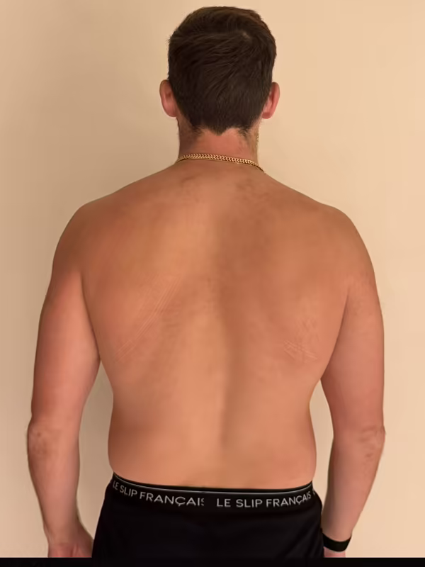 Owen from the back, day 1