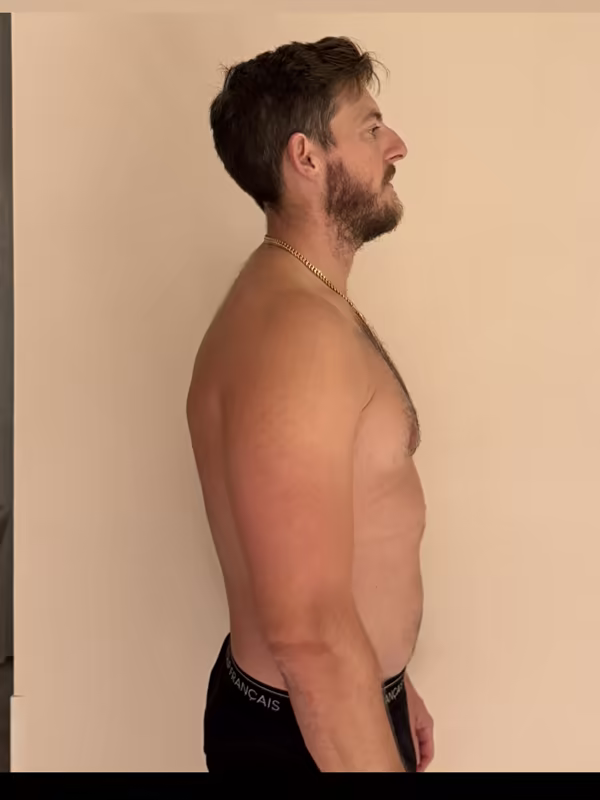 Owen from the side, day 1