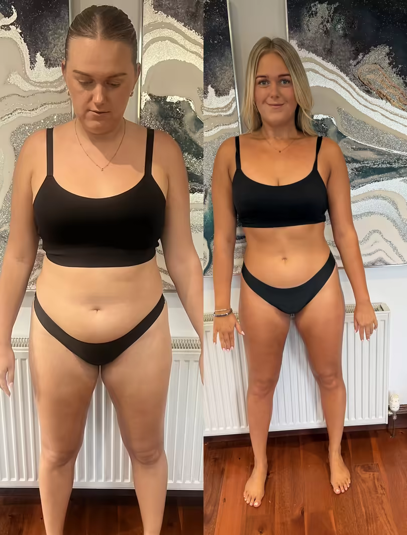 Samantha — before and after